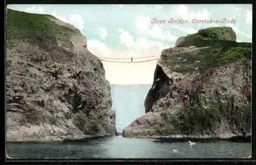 AK Carrick-a-Rede, Rope Bridge