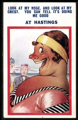 AK Profil einer Frau mit Sonnenbrand auf Brust und Nase