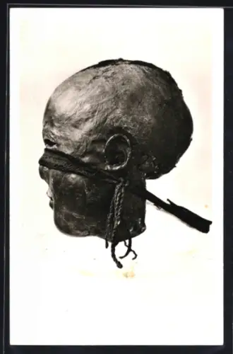 AK Windeby /Eckernförde, Kopf einer Moorleiche mit abgeschnittenem Haar