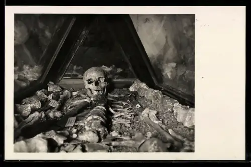 AK Hallstatt, Bergmannsskelett