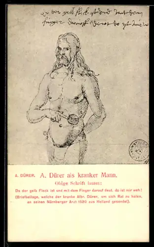 AK Portrait von Maler A. Dürer als kranker Mann
