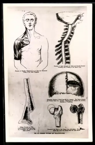 AK Muskel- und Knochenaufbau des menschlichen Körpers
