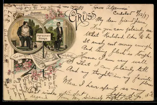 Lithographie Vorher-und Nachher-Bild im Zuge einer Badekur