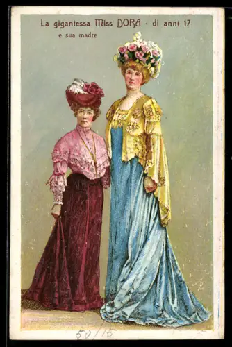 AK La gigantessa Miss Dora di anni 17 e sua madre