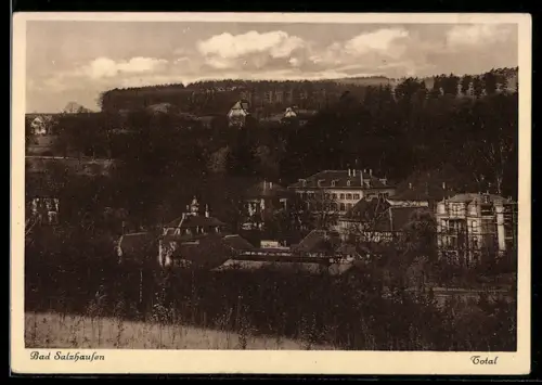 AK Bad Salzhausen, Total