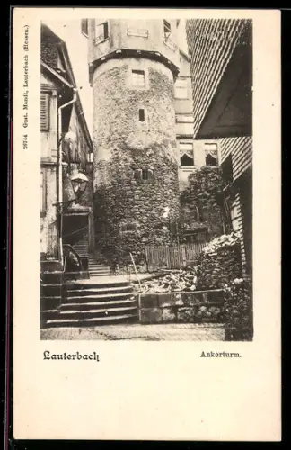AK Lauterbach /Hessen, Blick zum Ankerturm