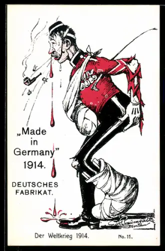Künstler-AK Propaganda 1. Weltkrieg, Made in Germany 1914, verkrüppelter Franzose spuckt Blut und Zähne aus