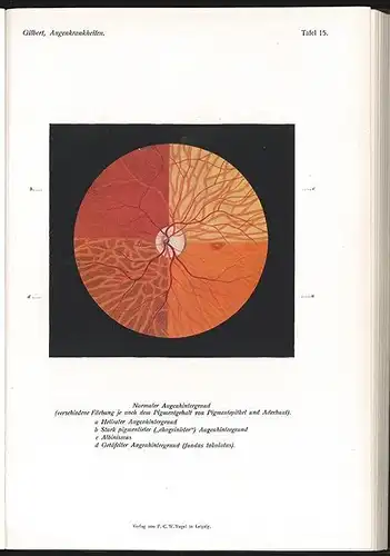 Die Augenerkrankungen im Kindesalter. Ein Buch für Studierende und Ärzte. GILBER