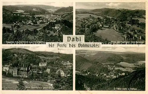 AK / Ansichtskarte Dahl_Hagen Gesamtansichten Fernblick zur Heilstaette  Dahl_Hagen