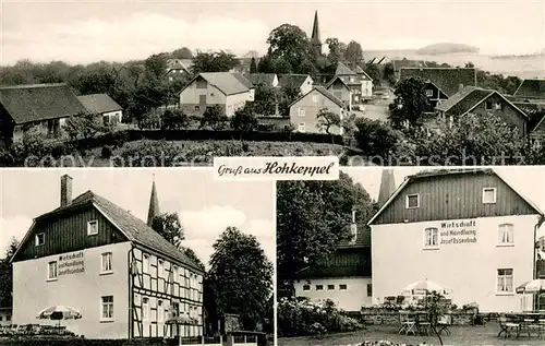 AK / Ansichtskarte Hohkeppel Gaststaeaete Ossenbach Aussenansichten mit Terrasse Hohkeppel