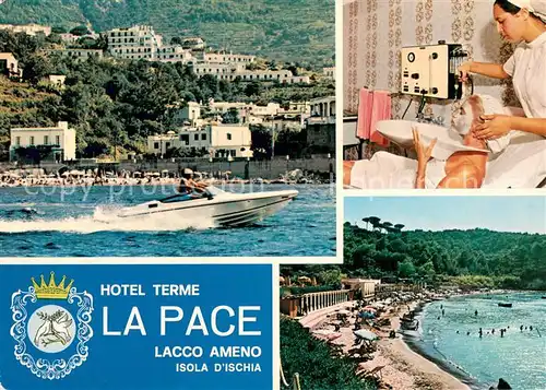 AK / Ansichtskarte Ischia Hotel Terme la Pace Massage Strand Ischia