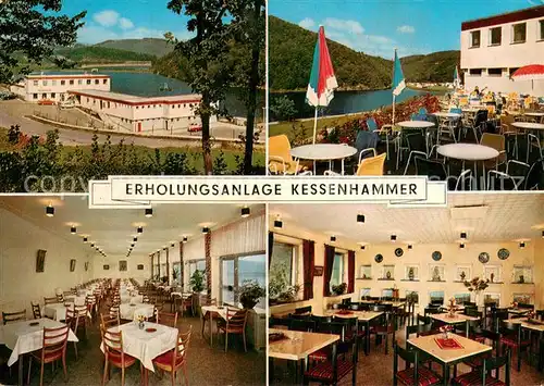 AK / Ansichtskarte Kessenhammer Erholungsanlage Kessenhammer am Biggesee Terrasse Gastraeume Kessenhammer