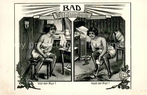 AK / Ansichtskarte Bad_Wildungen Die unuebertroffene Wirkung des Wildunger Wassers Vor der Kur und nach der Kur Kuenstlerkarte Bad_Wildungen