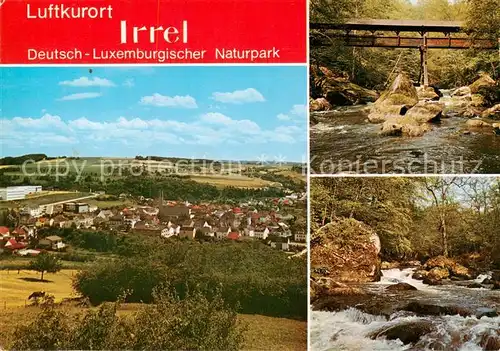 AK / Ansichtskarte 73813374 Irrel Deutsch Luxemburgischer Naturpark mit Wanderbruecke und den Wasserfaellen der Pruem Irrel