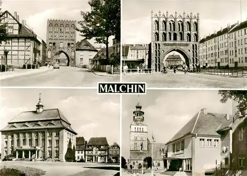 AK / Ansichtskarte 73892351 Malchin_Demmin Steintor Kalensches Tor Rathaus Fangelturm Malchin Demmin