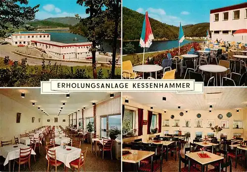 AK / Ansichtskarte 73925209 Kessenhammer Erholungsanlage Kessenhammer Gastraeume Terrasse