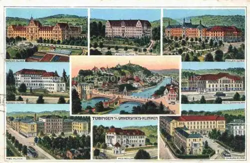 AK / Ansichtskarte TueBINGEN BW Universitaetskliniken