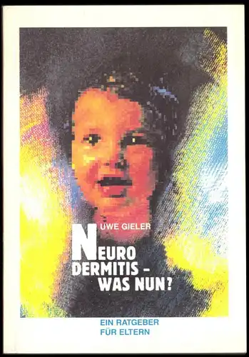 Gieler, Uwe; Neurodermitis - was nun? Ein Ratgeber für Eltern, 1992